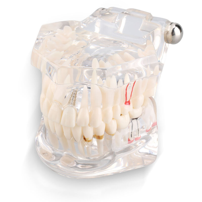 foto del prodotto  tude d enseignement de la maladie dentaire adulte typodont d monstration de dents mod le nouveau