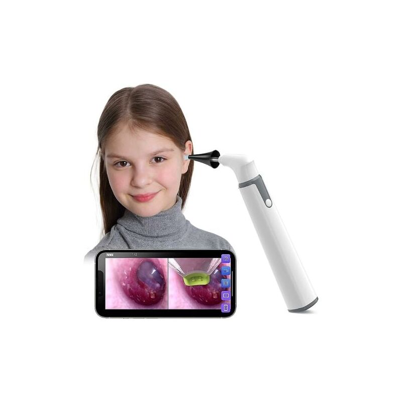 foto del prodotto otoscopio wireless per orecchio con doppia visualizzazione, oscilloscopio da 3,9 mm con 6 luci led