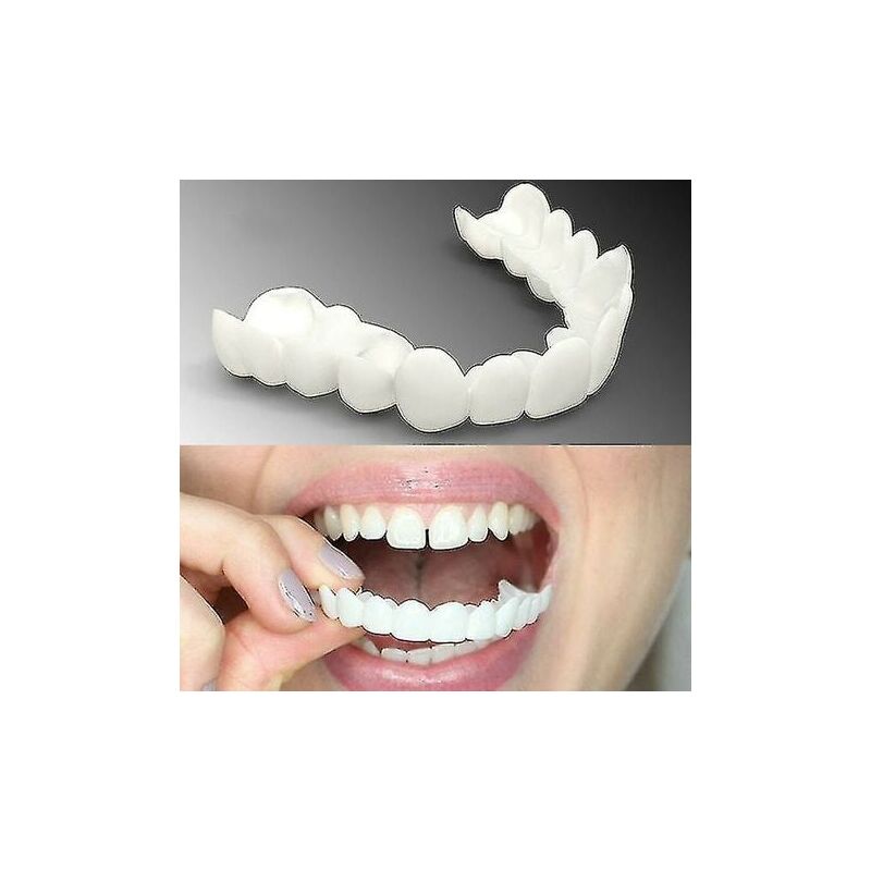 foto del prodotto snq apparecchi sbiancanti comfort fit flex superiori inferiori